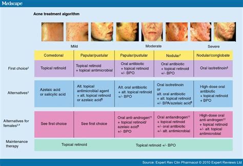 Acne Vulgaris | Time of Care