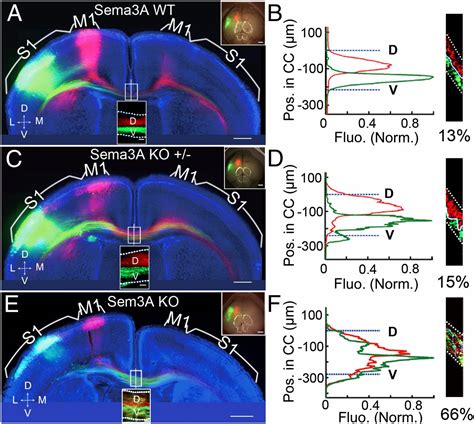 Axon Position Within The Corpus Callosum Determines Contralateral