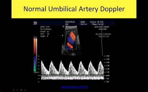 Ob Gyn Ultrasound Registry Review