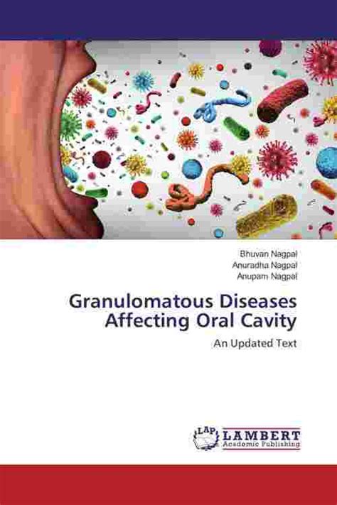 Pdf Granulomatous Diseases Affecting Oral Cavity By Bhuvan Nagpal