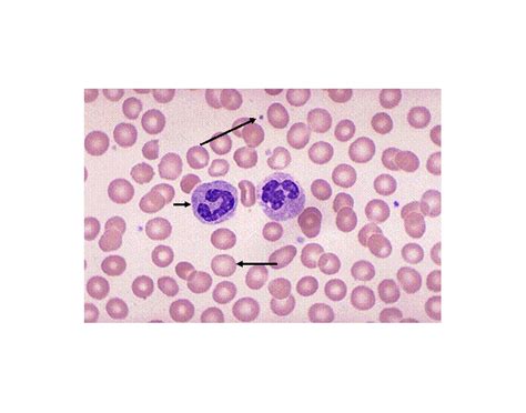 Blood Labeling Quiz