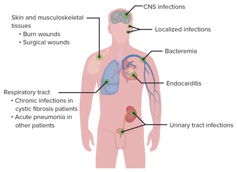 Pseudomonas Klassifikation Therapie Lecturio