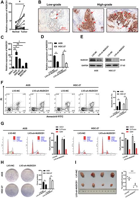 Identifying The Role Of Nudcd In Human Tumors From Clinical And