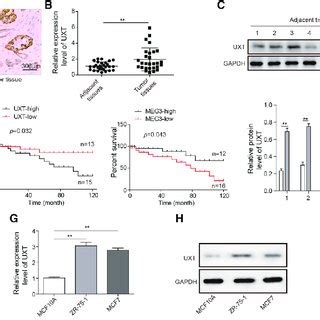 The Expression Patterns Of UXT And MEG3 In Breast Cancer A