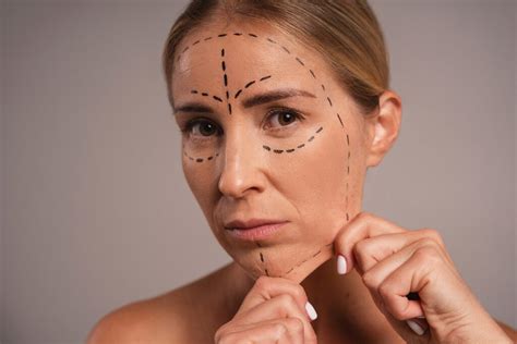 Flacidez Facial O Que Como Prevenir E Como Tratar