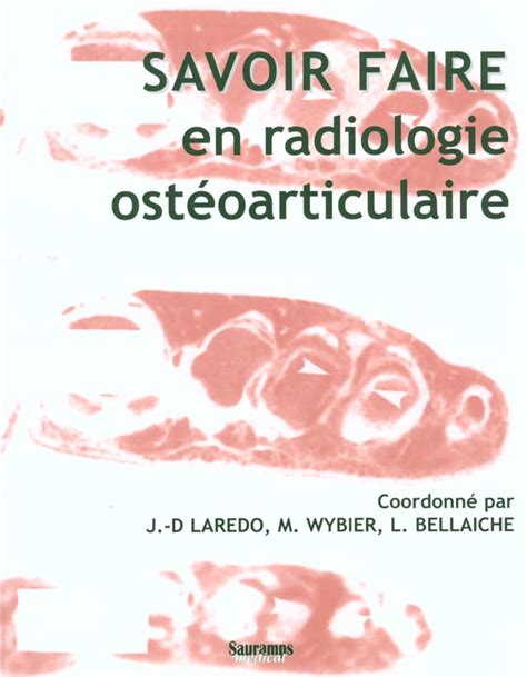 Savoir Faire En Radiologie Osteo Articulaire Jean Denis Laredo