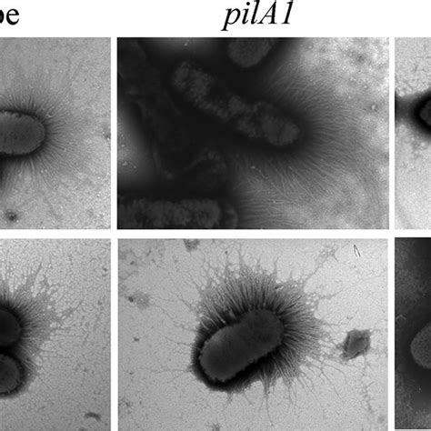 Transmission Electron Microscopy Of Pilus Formation By X Fastidiosa