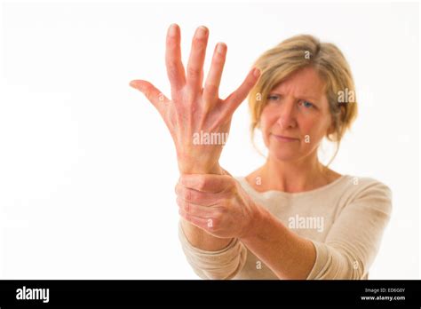 A Forty Year Old Caucasian Woman With Painful Arthritis In The Joints