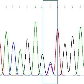 Schematic Representation Of The M680I Mutation In Exon 10 Of MEFV Gene