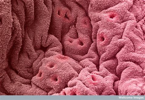 Wellcome Images Endometrium Showing Glands Microscopic Photography