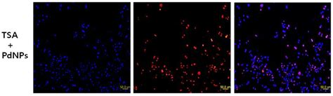 Effect Of TSA Or PdNPs Alone Or In Combination On Apoptosis In Human