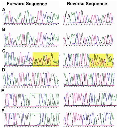 Sequence Chromatograms Of Affected And Control Individuals The Forward Download Scientific