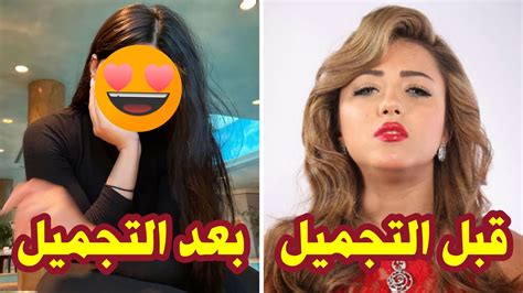 مجلة عالم المعرفة شاهد الفنانة سارة سلامة تقـع ضـحـيـة عمليات التجميل