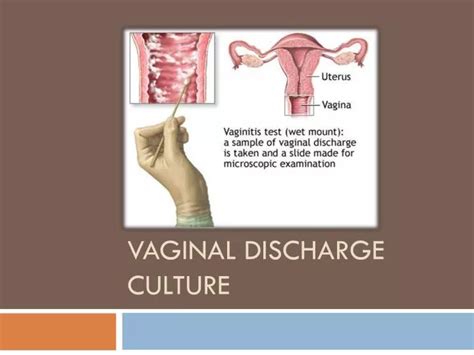 Ppt Vaginal Discharge Culture Powerpoint Presentation Id 4136140