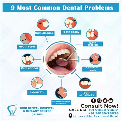 Most Common Dental Problems Dental Hospital Dental Problems Gum