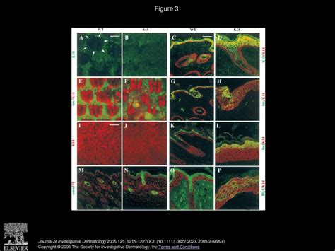 Different Consequences of β1 Integrin Deletion in Neonatal and Adult