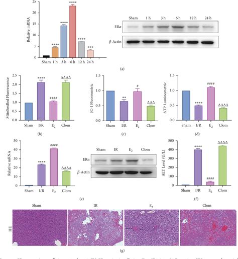 Figure 2 From Ginsenoside Rg1 Alleviates Hepatic Ischemia Reperfusion