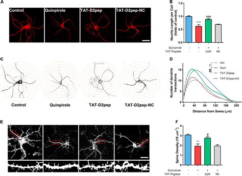 Frontiers Prevention Of Neurite Spine Loss Induced By Dopamine D