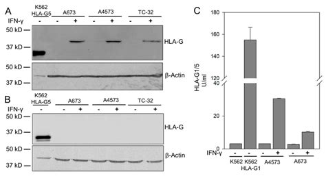 IFN γ stimulated EwS cells express HLA G isoform G1 A B Western Blot