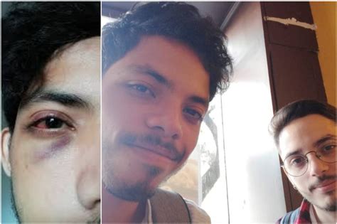 TERRIBLE En Argentina Sujetos Persiguieron Y Atacaron A Una Pareja Gay Uno De Los Agredidos