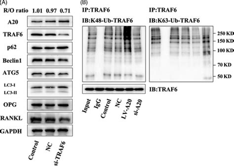 A20 Inhibits Osteoclastogenesis Via Traf6‐dependent Autophagy In Human