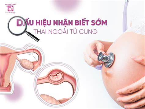 Tìm hiểu biểu hiện thai ngoài tử cung và cách xử lý hiệu quả