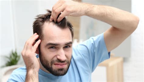 7 Most Effective Ways To Curb Hair Loss In Men