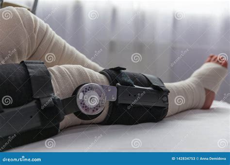 Female Leg After Knee Surgery In Bandages And Orthosis Stock Image