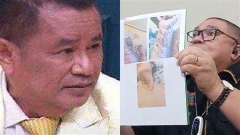 Razman Arif Nasution Ungkap Foto Percobaan Bunuh Diri Iqlima Kim Minta