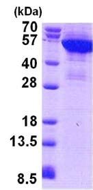 Recombinant Human Cytokeratin 8 protein denatured ab156729 アブカム