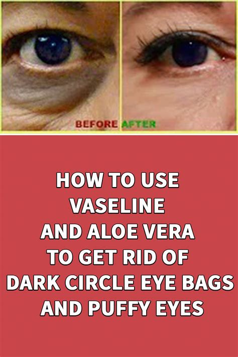 How To Get Rid Of Eye Bags With Vaseline Howotre