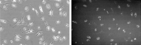 Primary Human Hepatic Stellate Cells Hscs Show The Characteristic Download Scientific Diagram