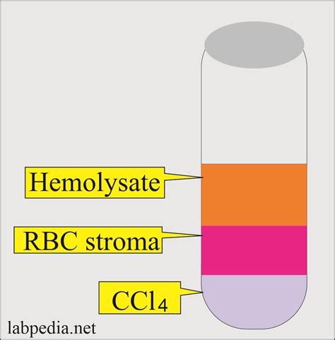 Hemoglobin Part 2 Hemoglobin Electrophoresis Hb Electrophoresis