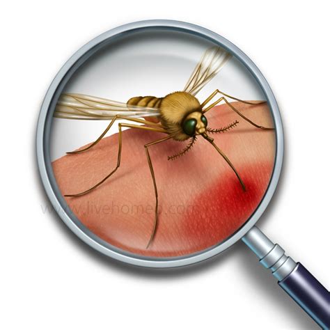 Health Tips For Mosquito Borne Diseases Live Homeo