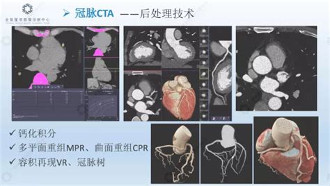 第十一期：广州中心《心血管专场》影像技术评审会全景医学影像