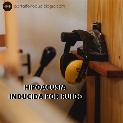 Hipoacusia Inducida Por Ruido Portal Fonoaudiologia