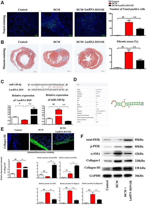 Lncrna H19 Inhibits Er Stress Induced Apoptosis And Improves Diabetic