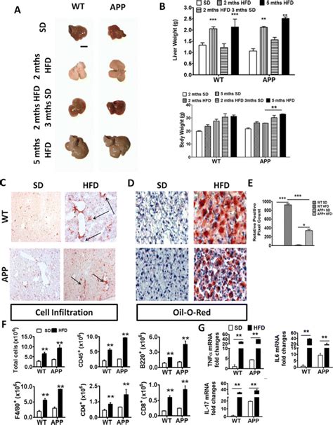 HFD Induced Acute Liver Pathology And Inflammation In WT And APP Tg And