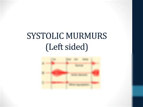 Solution Valvular Heart Disease Focus On Aortic Stenosis And Mitral