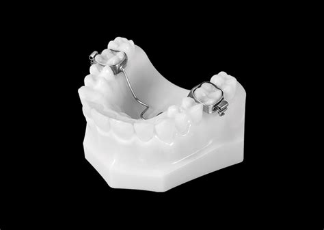 Transpalatal Arch Appliance Universal Orthodontic Lab