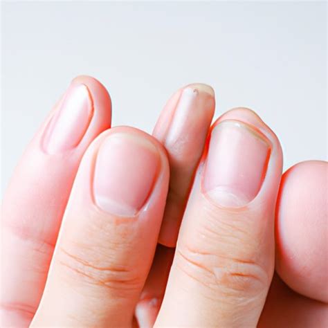 What Does A Healthy Fingernail Look Like A Comprehensive Guide The