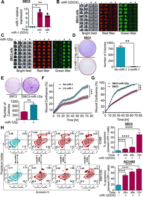 Mir Modulates Growth And Migration Of Sclc Cells A Mir Expression