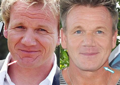 Gordon Ramsay Before And After 2022