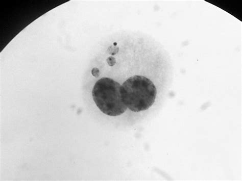 Binucleated Lymphocyte With 3 Mn Download Scientific Diagram