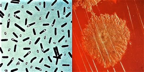 Morphology Culture Characteristics Of Clostridium Botulinum