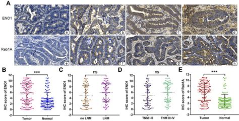 Expression Of Eno1rab1a In Crc Tissues A Immunohistochemical Ihc