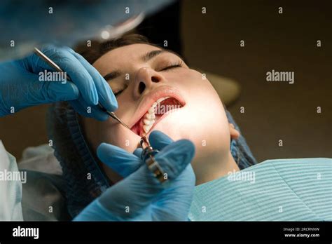 Dental Surgeon Performs Conduction Anesthesia With Lidocaine Using A