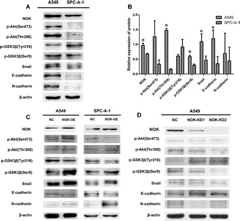 Nok Mediated Activation Of Akt Gsk Pathway In Nsclc Cell Lines A