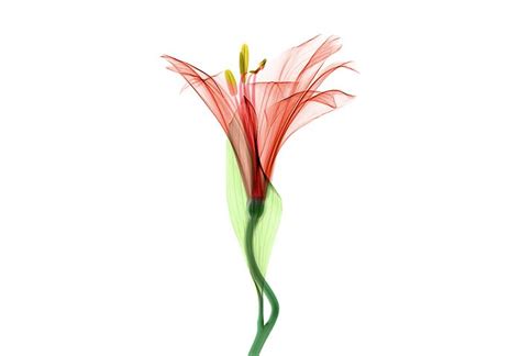 50+ Free Xray & Radiology Images - Pixabay