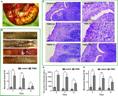 2,4,6-trinitro-benzene-sulfonic acid (TNBS)-induced cecum inflammation ...